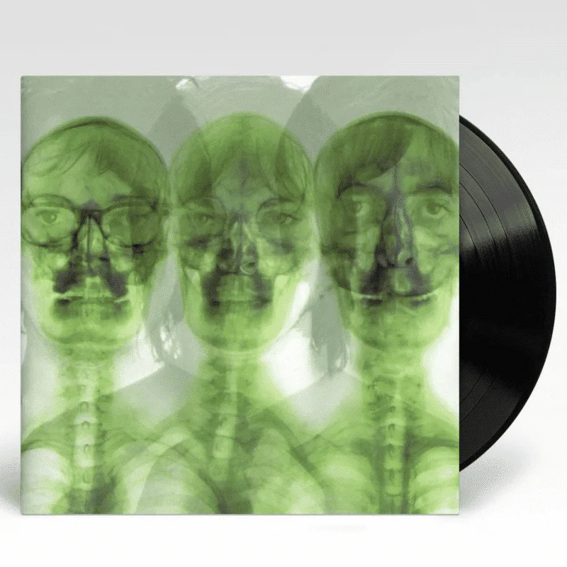 Supergrass